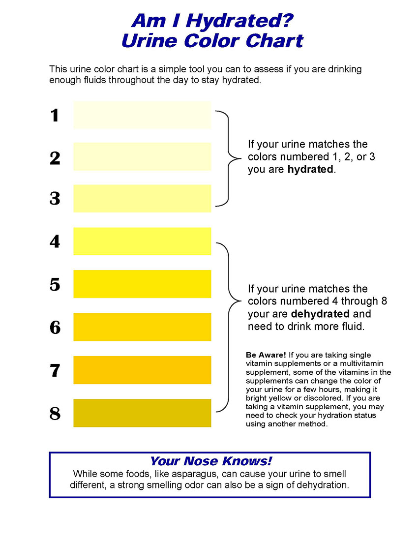 A urine color chart.