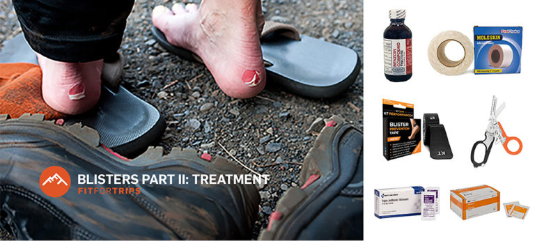 How To Treat Blisters on Feet: During and After Hiking and Walking