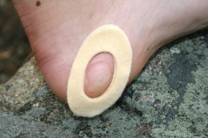 Donut pads are also used to treat heel blisters.