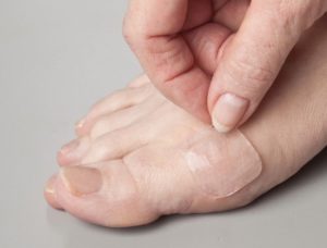 Cover the foot blister with second skin material.