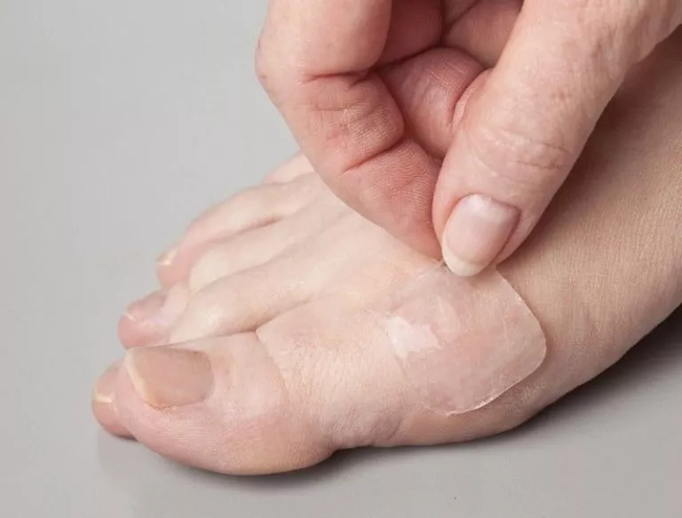 How To Treat Blisters on Feet During and After Hiking and Walking