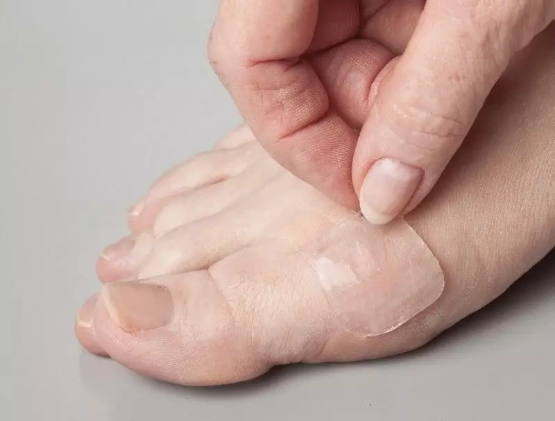 How To Treat Blisters on Feet During and After Hiking and Walking